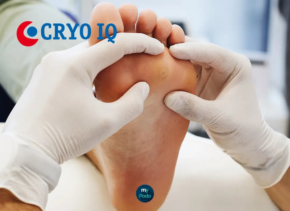 Comment utiliser le CryoIQ sur une verrue plantaire : le protocole étape par étape My Podologie