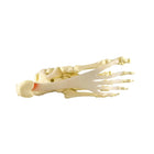 Plantar Fasciitis Model – Foot/Ankle