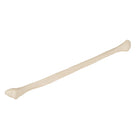 Fibula - Anatomie et pathologie